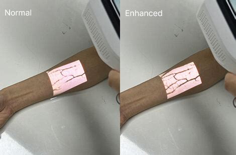 AIMVEIN Pro 3.0 | New-Gen Vein Finder | Aimvein®