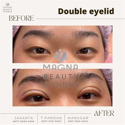 magna studio jakarta layanan harga booking treatment