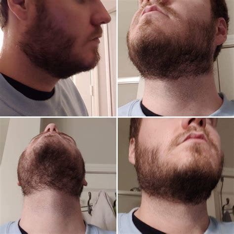 First Time Beard Grower 5 Weeks In - How does my neck line look? Used the double chin method and