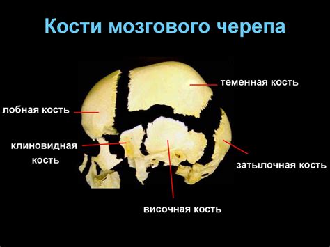 Рентгеноанатомия черепа - презентация онлайн
