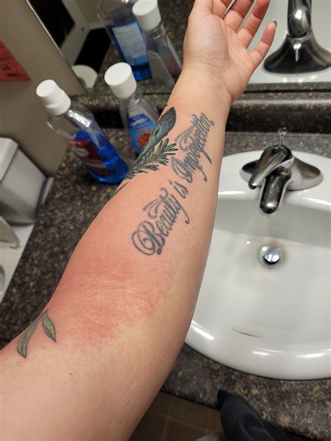 Urticaria Tattoos Urticaria Pigmentosa Stock Image C056/1162