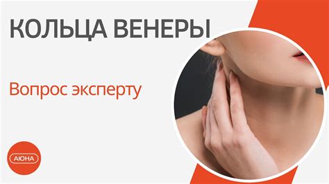 Кольца венеры: вопрос эксперту - YouTube