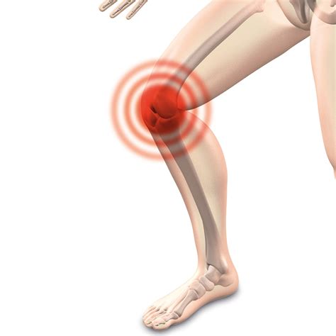 Knee Pain When You Squat or Run? - Physio Plus