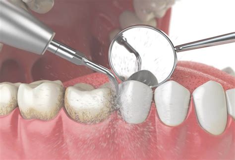 About Apollo Medical Centre | UAE
