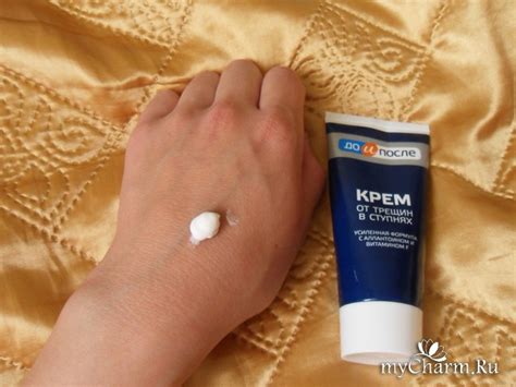 Что помогает от мозолей на руках: С рук долой: как избавиться от ...