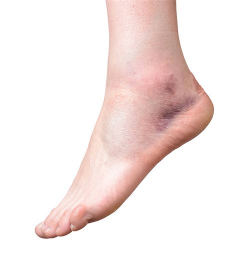 lateral ankle ligaments