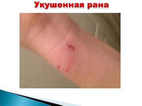 МГМСУ им А И ЕВДОКИМОВА Кафедра хирургических болезней