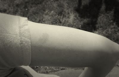 Dear Person Reading This,: Birth Mark