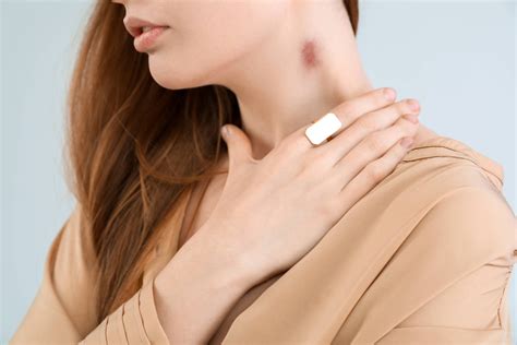 O Que Acontece Se Tirar As Argolas Do Pescoço - Chupão no pescoço mata? Médico explica os riscos da prática | Jornal ...
