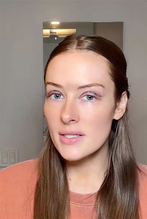 Plastic surgery expert unpacks Brooke Schofield's latest procedure as