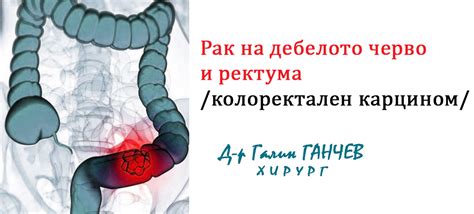 Д-р Галин ГАНЧЕВ - хирург