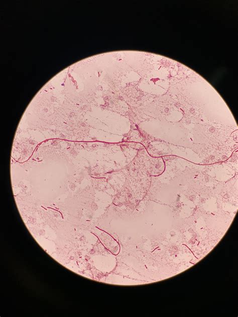 Gram stain from an anaerobic blood culture bottle : r/medlabprofessionals