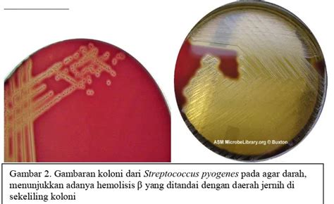 Gambar Koloni Pada Agar Darah - 35+ Koleksi Gambar