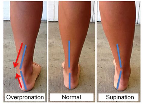 path  healthier feet