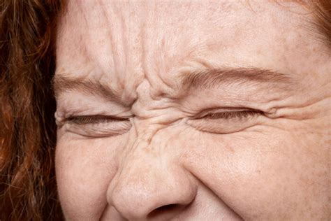 Linhas De Expressão Embaixo Dos Olhos - Linhas de expressão nos olhos: como prevenir o envelhecimento cutâneo ...