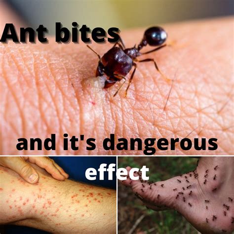 Big Red Ant Bite