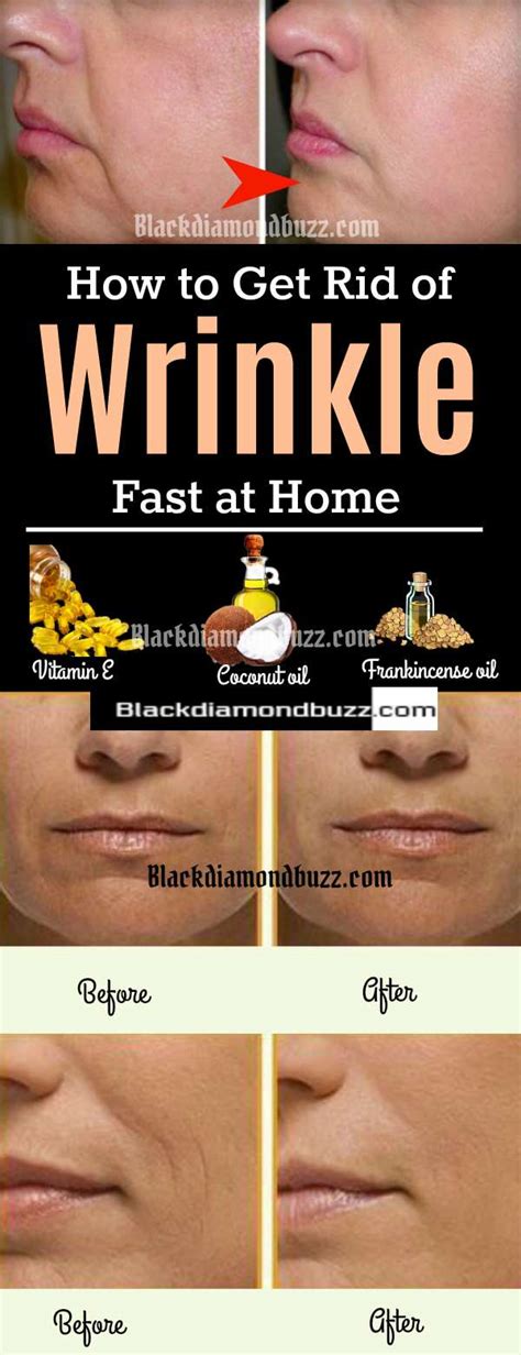 How To Get Rid of Wrinkle - 10 Best Homemade Anti-Wrinkle Creams