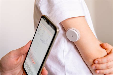Professional Continuous Glucose Monitors