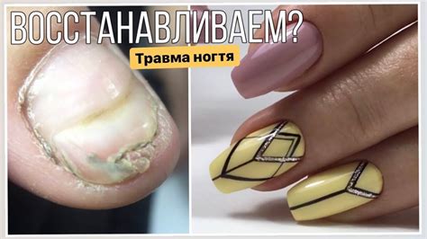 Треш, а не ноготь//Восстановление/Рисуем геометрию - YouTube