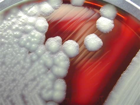 Bacillus cereus - Wikipedia, frjálsa alfræðiritið