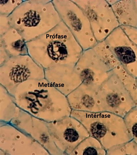 mitose da raiz fotonucleomajpg