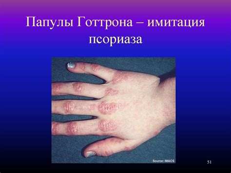 Дифференциальный диагноз суставного синдрома - презентация онлайн