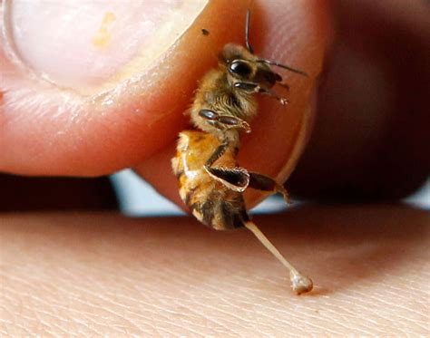 Bee Sting Anatomy