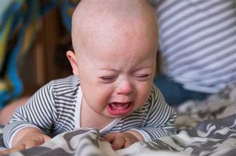 Cute Baby Boy With Down Syndrome Crying Stock Photo - Download Image ...