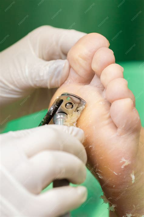 Premium Photo | Pedicure procedure in the beauty salon. emover calluses