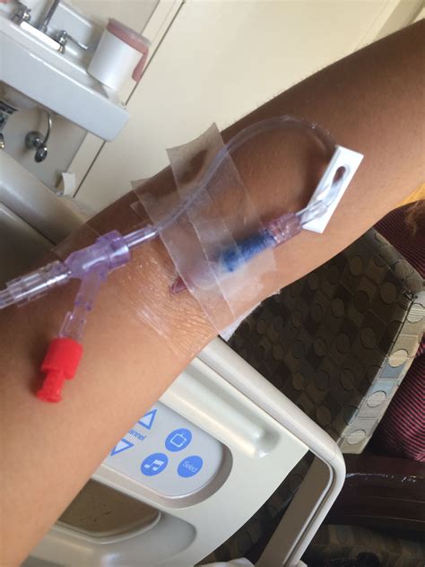 Agulha Para Soro Na Veia