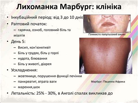 Геморагічні лихоманки - презентация онлайн