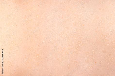 Water droplets on the skin background Stock Photo | Adobe Stock