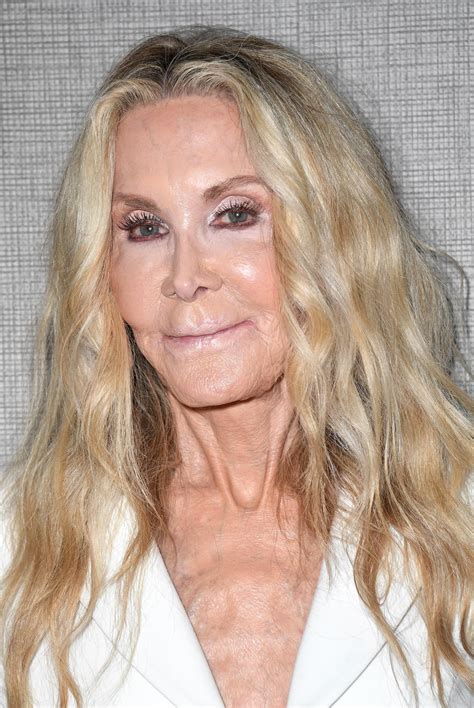 6 Famous Beauties Who Allegedly 'Ruined' Their Faces with Plastic