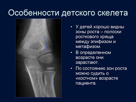 Лучевая диагностика травматических повреждений костно-суставной системы ...