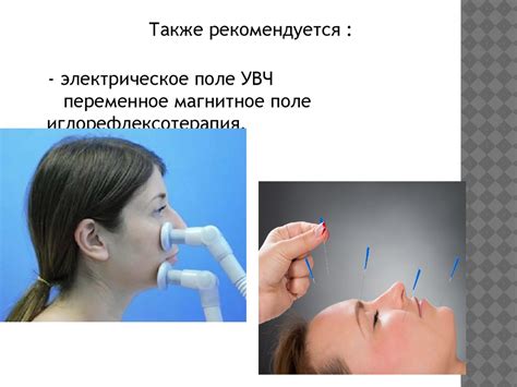 Нейропатия лицевого нерва - презентация онлайн