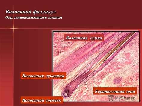 Презентация на тему: "ЛЕКЦИЯ: КОЖА И КОЖНЫЕ ПРОИЗВОДНЫЕ Общий план ...