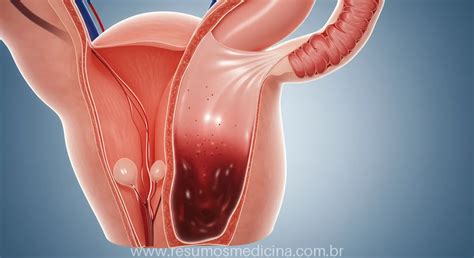 O Hímen Pode Se Fechar Novamente - Hímen Imperfurado: O Guia Completo Sobre Causas, Sintomas e Tratamento ...