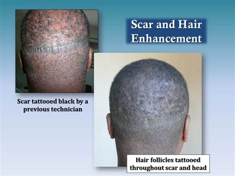 how to grow hair on scar naturally