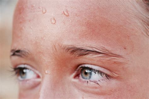 Suor Excessivo Na Cabeça E Rosto - Melhor Tratamento para Suor Excessivo no Rosto? | Confira!