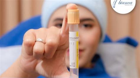 prp klinik kecantikan bianca