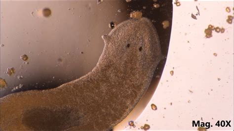 Planaria Under Microscope Labeled