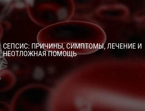 Сепсис: симптомы, причины развития и методы лечения опасного заболевания
