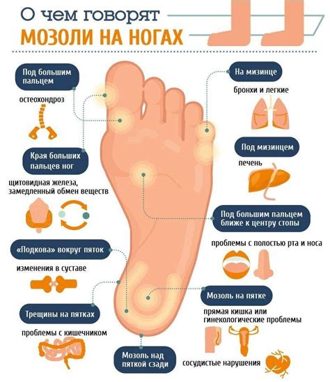 Стержневая мозоль на ступне: удаление и лечение в домашних условиях, фото