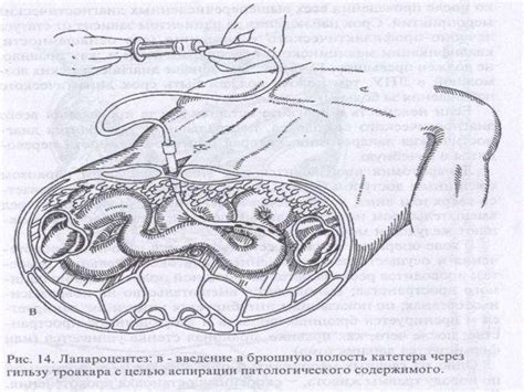 Травма живота - презентация онлайн