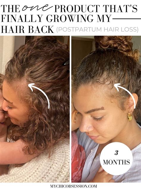 The One Product That Grew My Hair Back | Jamaican Black Castor Oil for ...