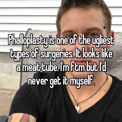 transgender men share  eye opening thoughts  phalloplasty