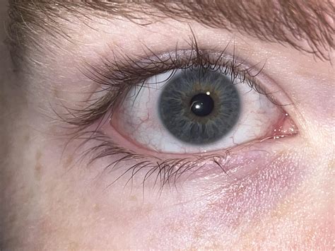 Scientists found why people have blue eyes and blonde hair 24