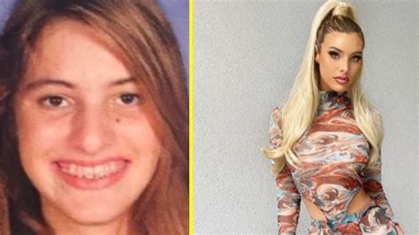 Lele Pons comparte el increíble antes y después de su rinoplastia ...