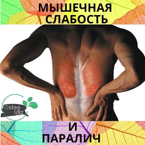 Мышечная слабость – Остеопатія Україна
