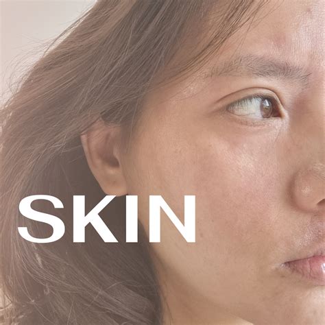 Sibo Skin – Learn more about the connection between Small Intestinal ...